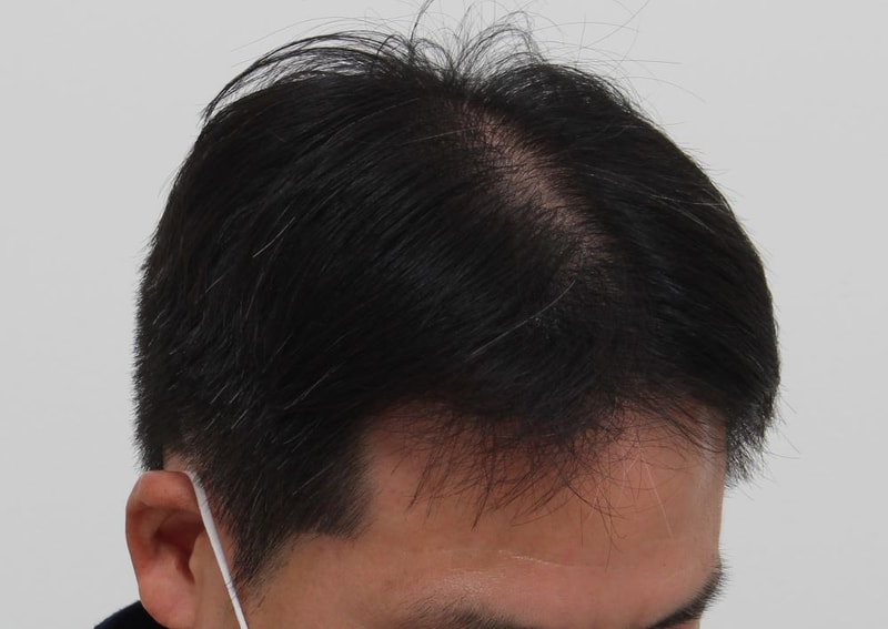 07.9개월차.JPG