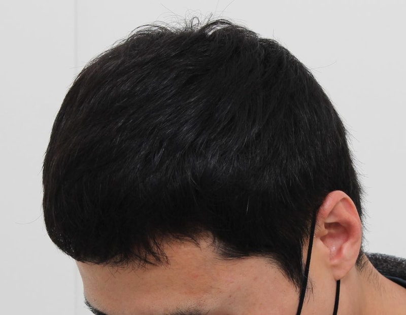 05.수술전.JPG