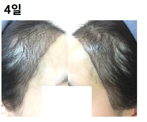 제목 없음.png