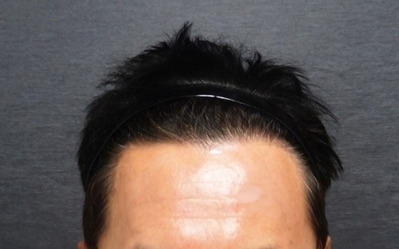 술후01.jpg