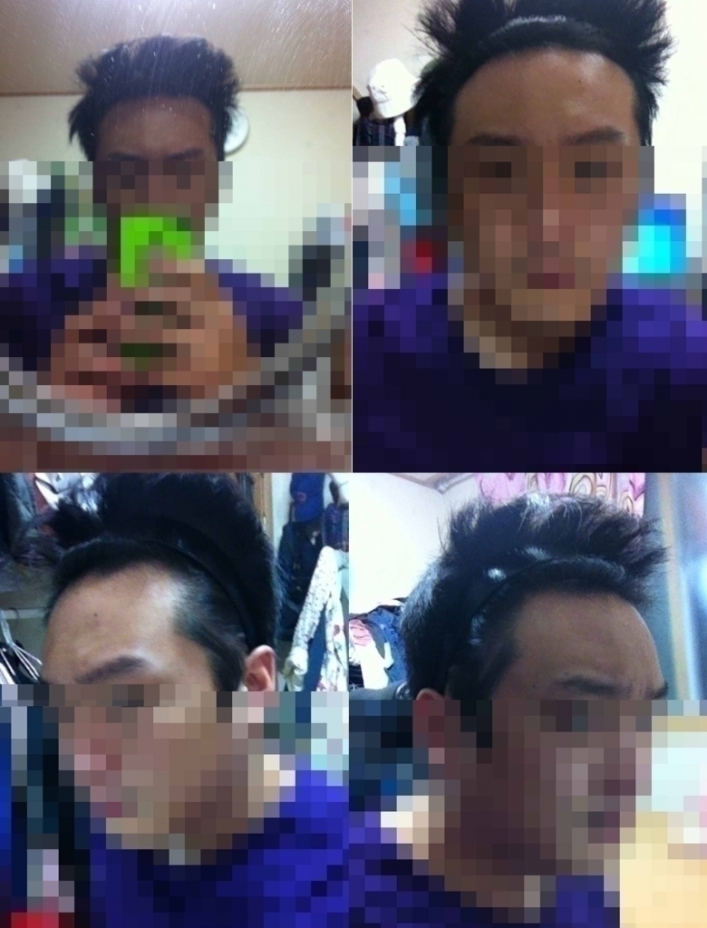 수술전.jpg