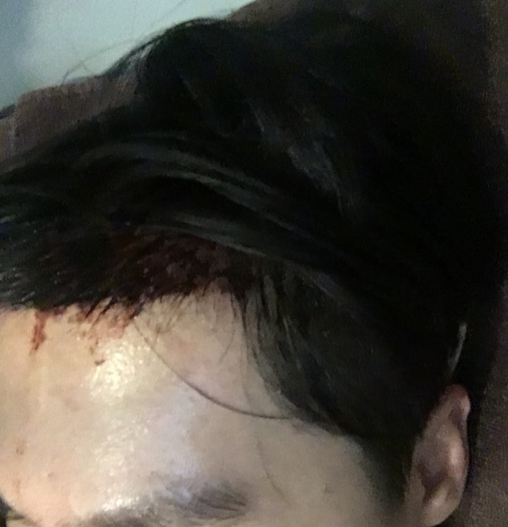 2일차오전샴푸전.jpg