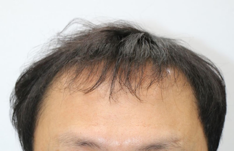 09.수술전.JPG
