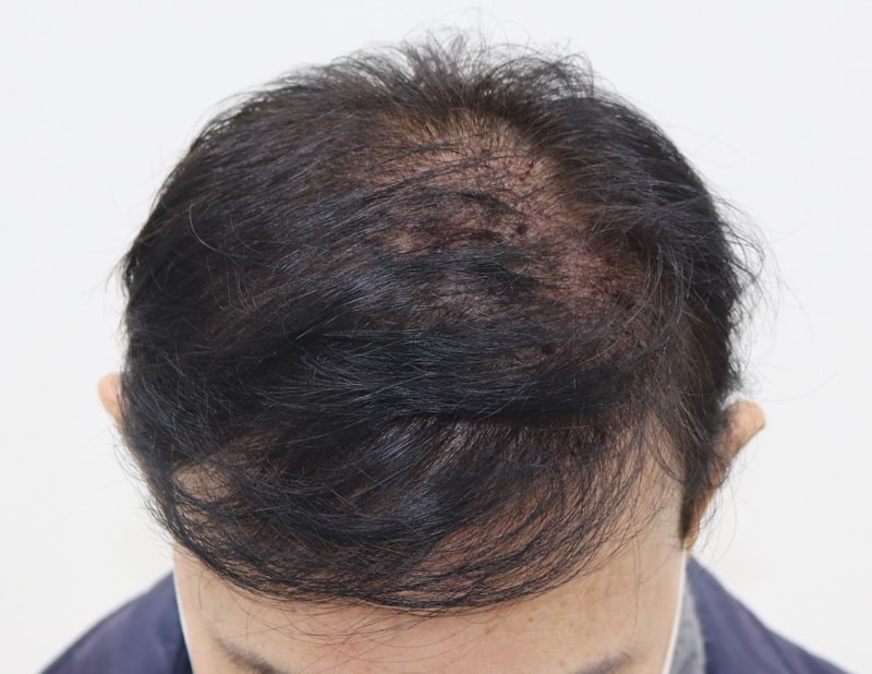 03.이식당일.JPG