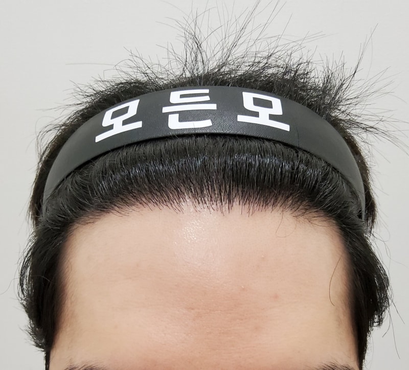 6. 수술후_1년_1.jpg