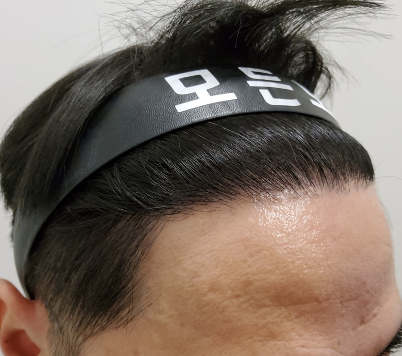 4. 수술후_1년_2.jpg