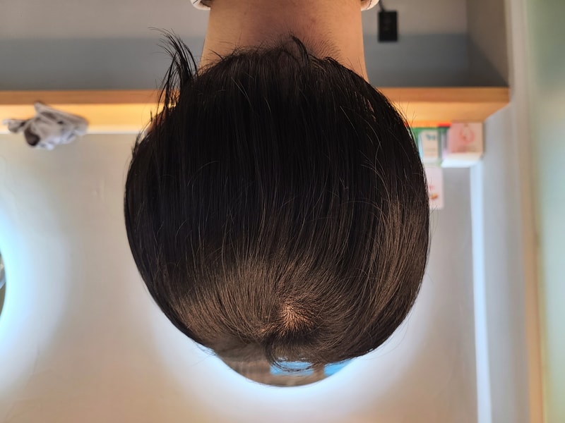 2. 수술후_1일_4.jpg