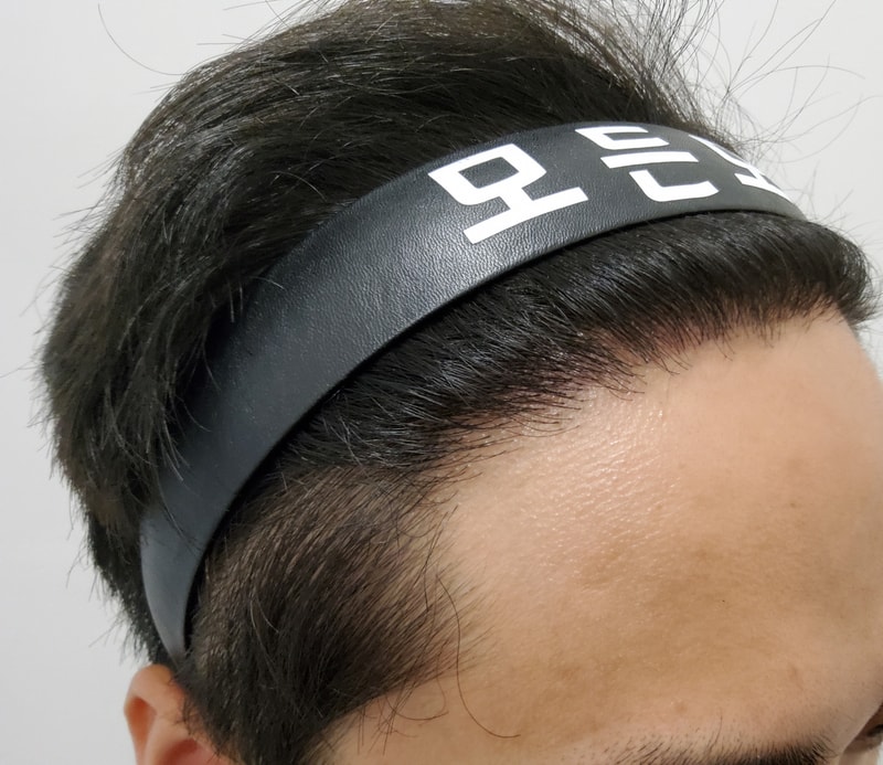 4. 수술후_1년_2.jpg