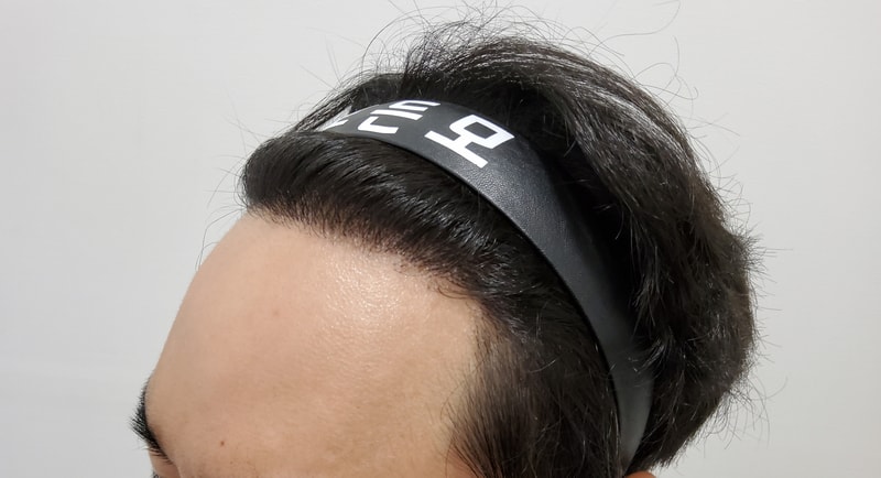 4. 수술후_1년_2.jpg