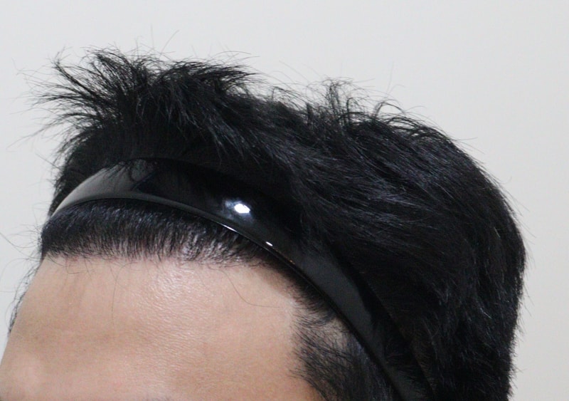 5. 수술후_6개월_2.JPG