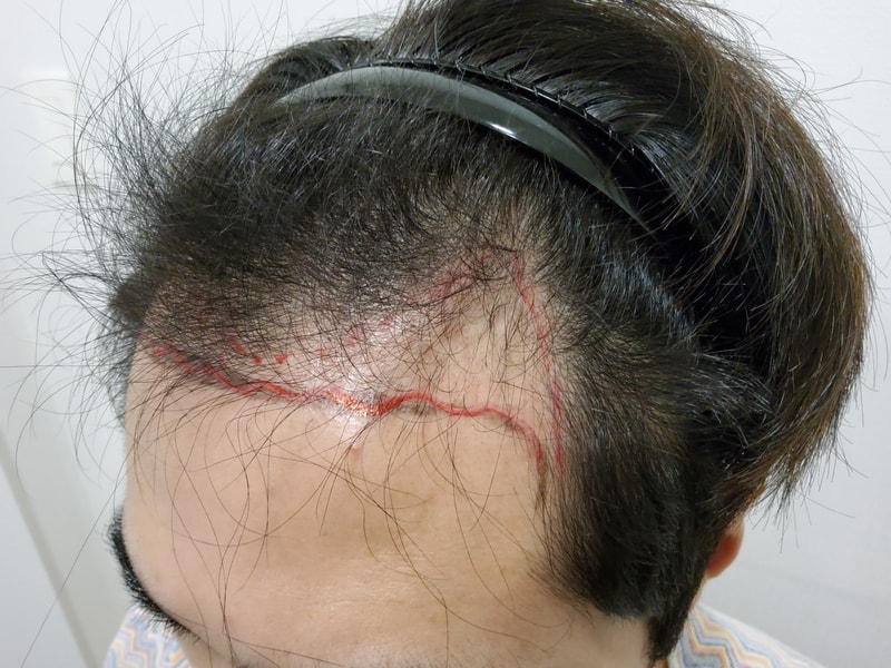 1. 수술전_3.jpg