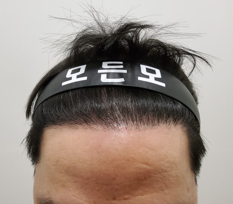 4. 수술후_1년_1.jpg