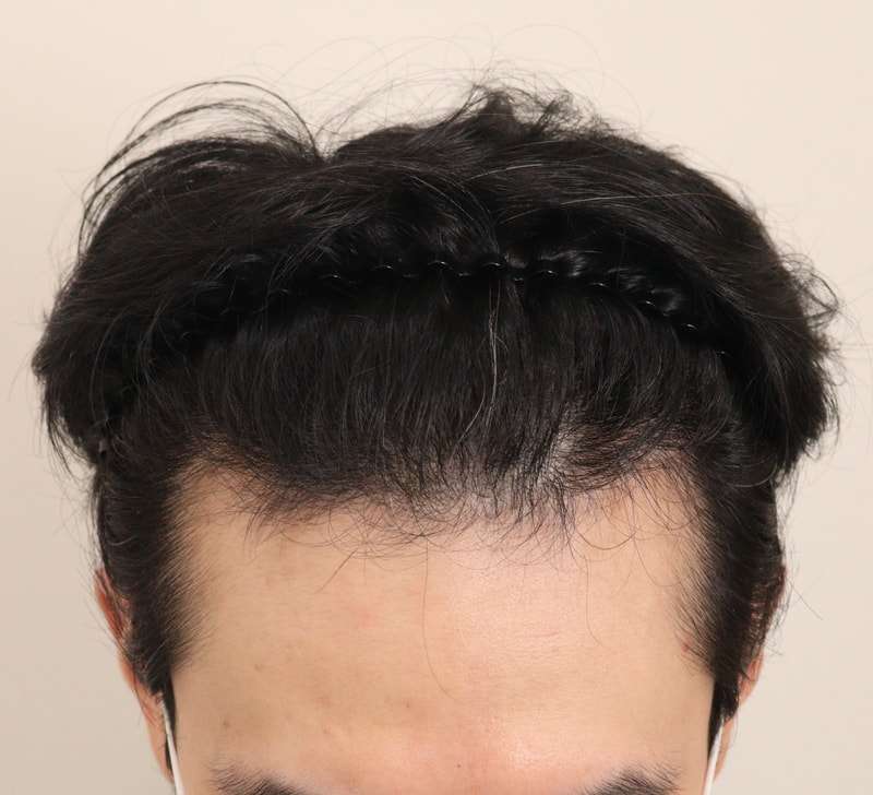 1. 수술전_2.JPG