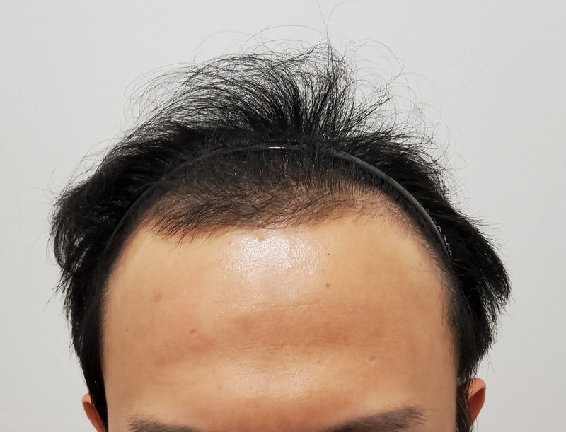오랜만에 후기 공유하러 왔습니다!