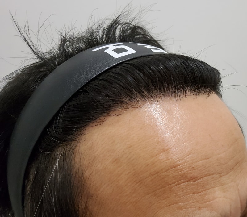 수술후_1년_3.jpg