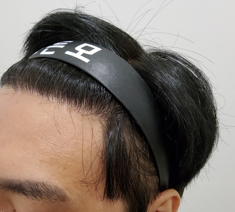 4. 수술후_1년_2.jpg