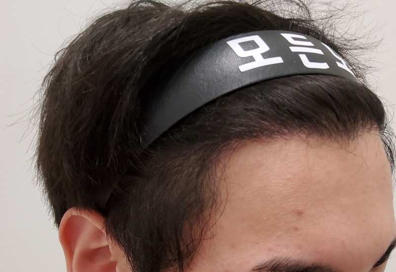 4. 수술후_6개월_3.jpg