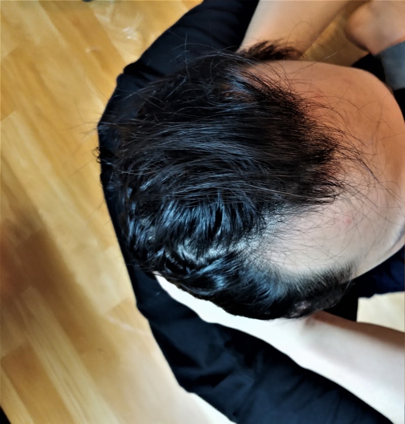 수술전.gif
