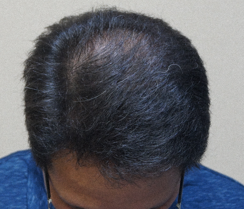 opDSC01407.JPG