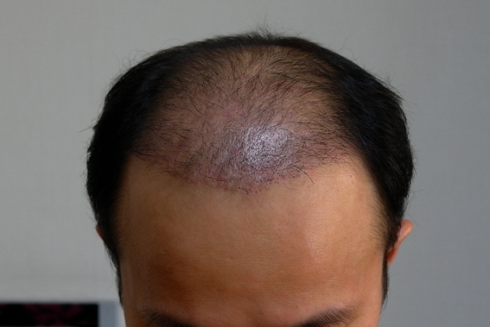 opL1006186.JPG