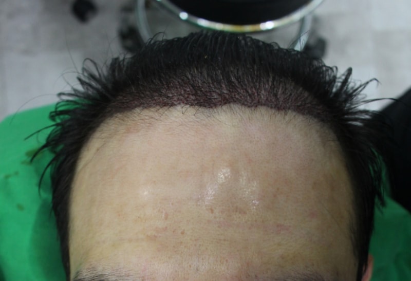 444.png