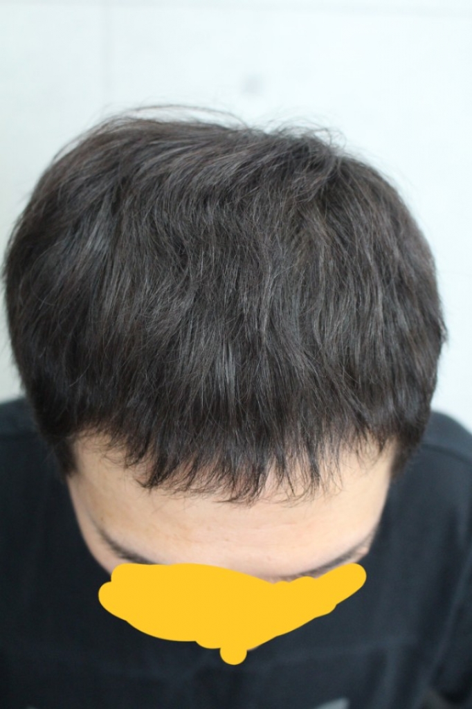 ㅁㅁ.jpg