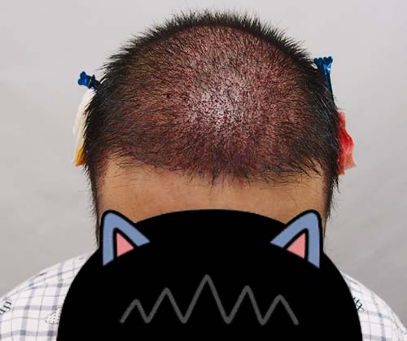수술직후1.jpg