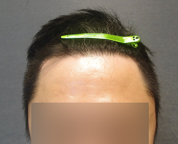 후1.jpg