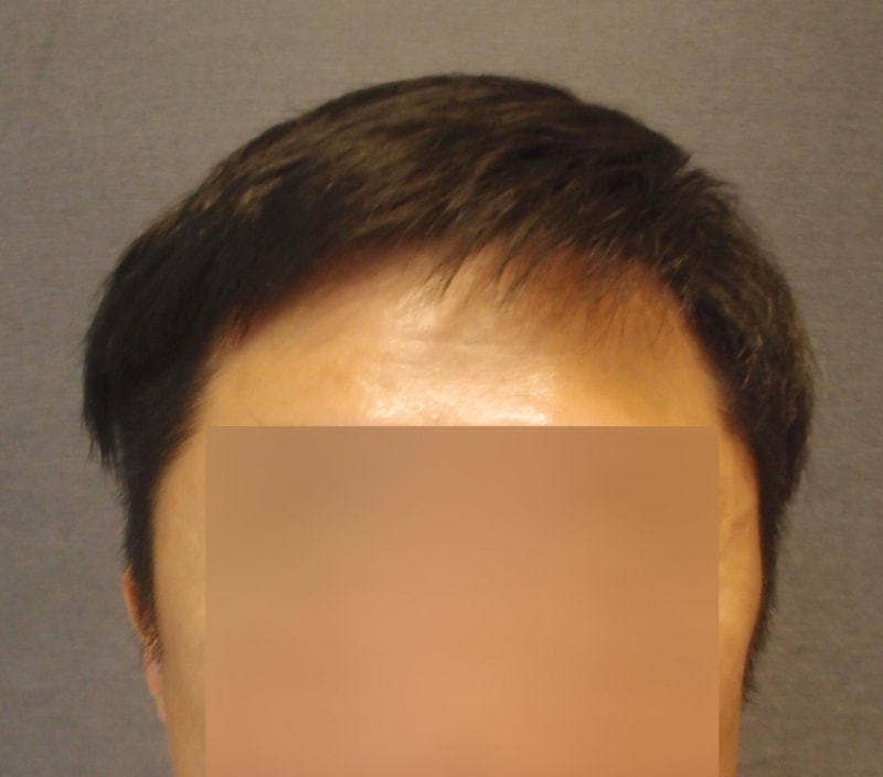 후2.jpg