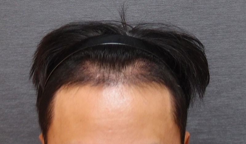 수술후4.jpg