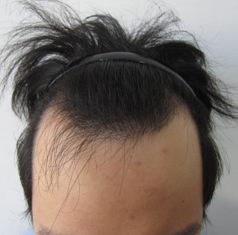 수술전.JPG
