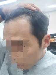 수술전 1.jpg