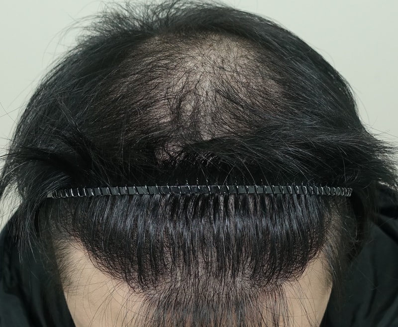 8개월 윗면.jpg