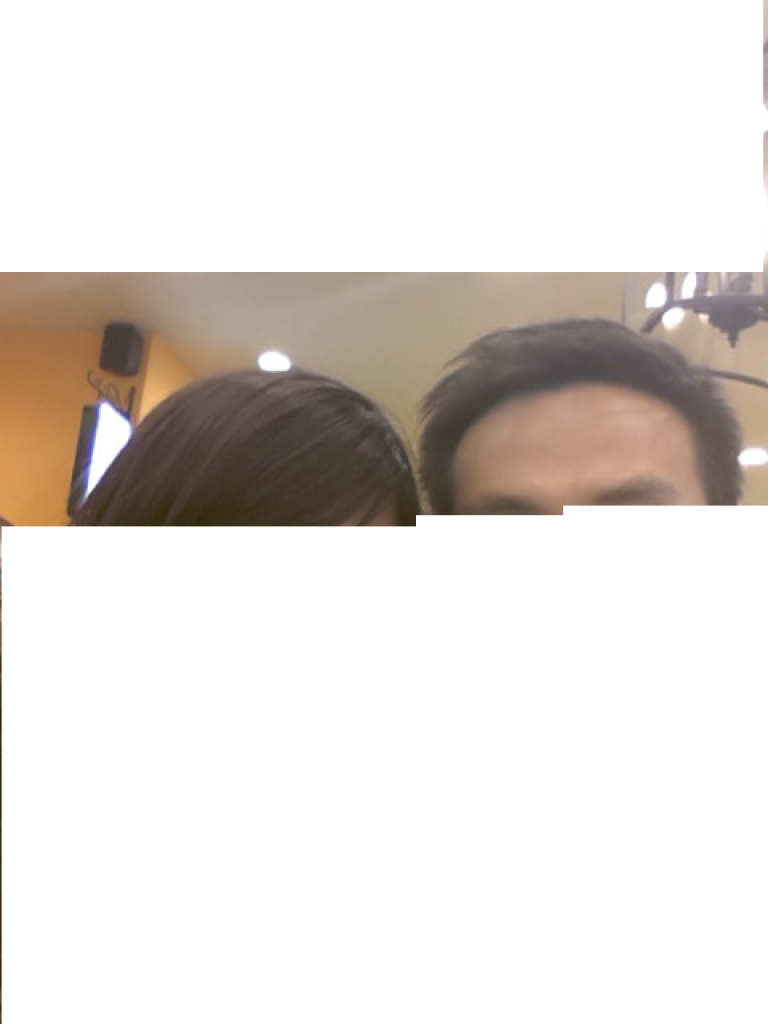 이식후 6개월.png