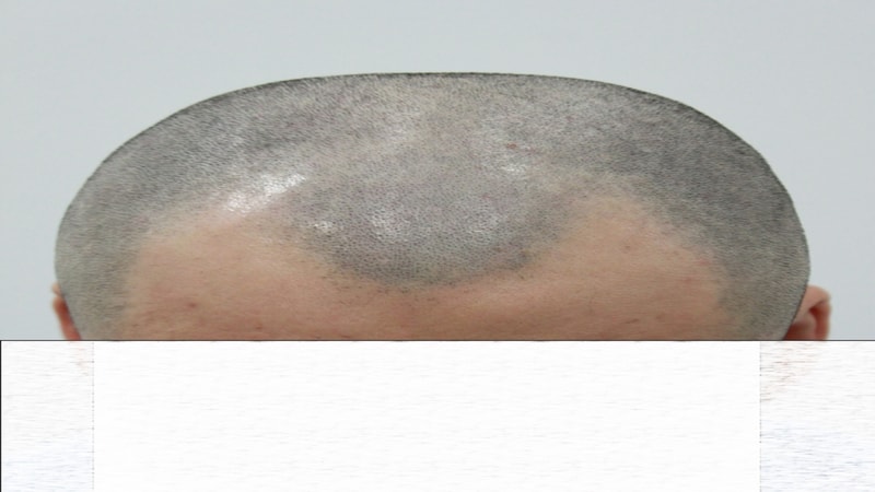수술전 삭.jpg