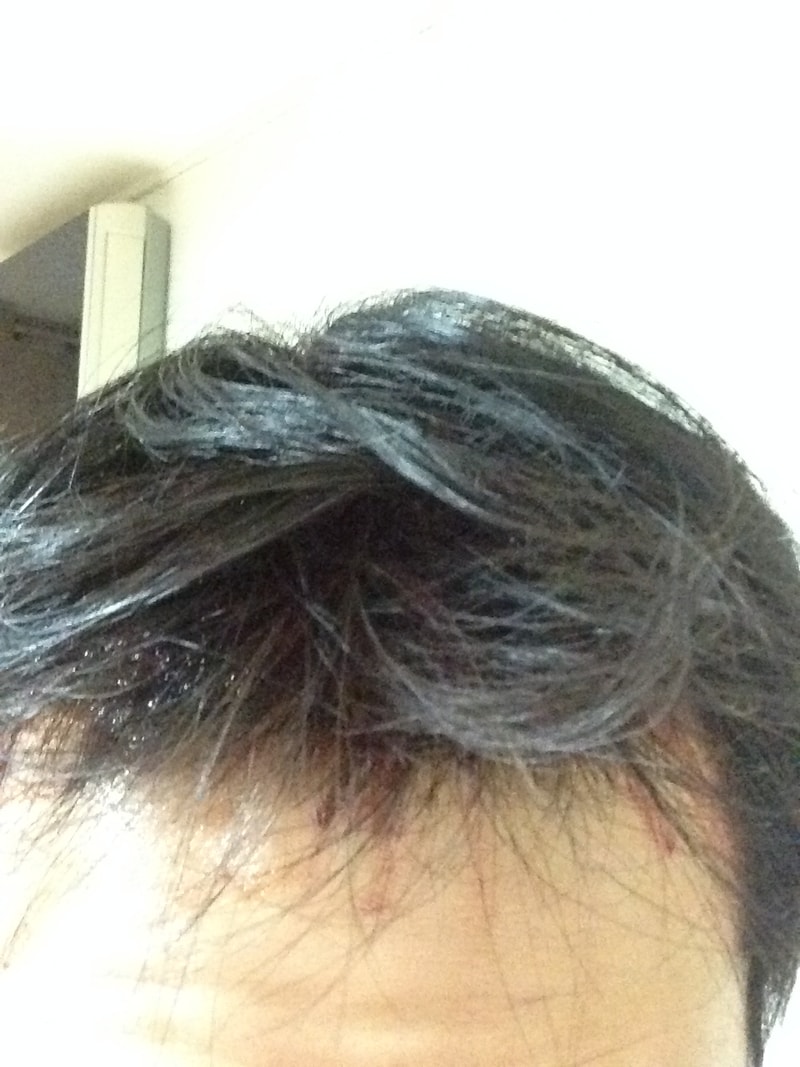 수술당일 2.JPG