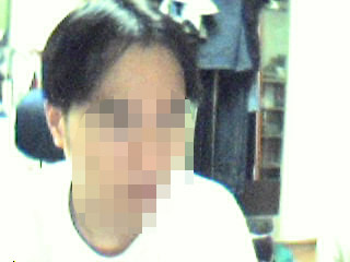 수술 후 1년 3.jpg