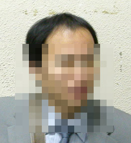 수술 전 일반 1.jpg