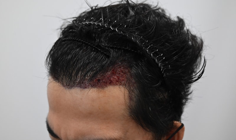샴푸1.jpg