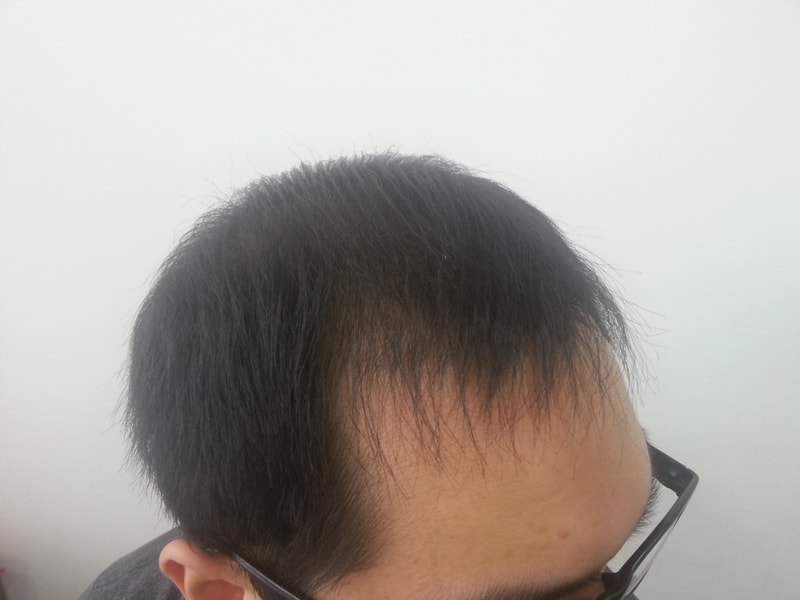 4개월2.jpg