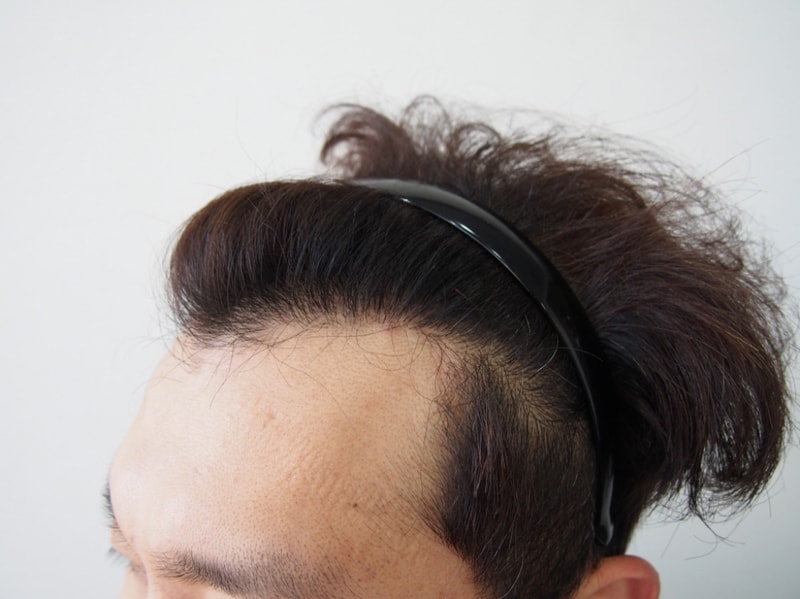 크기변환_9개월 왼쪽1.JPG