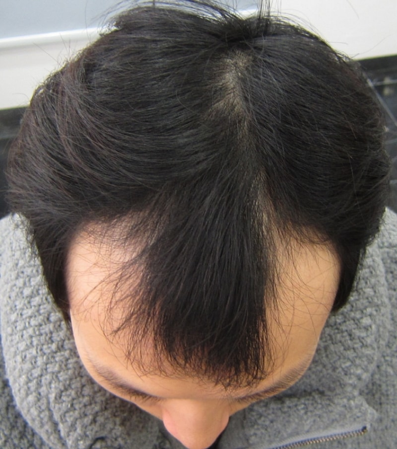 수술전 1.JPG