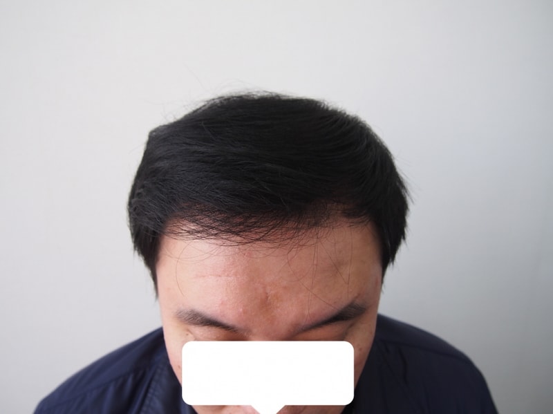 크기변환_23588vP3201722.JPG
