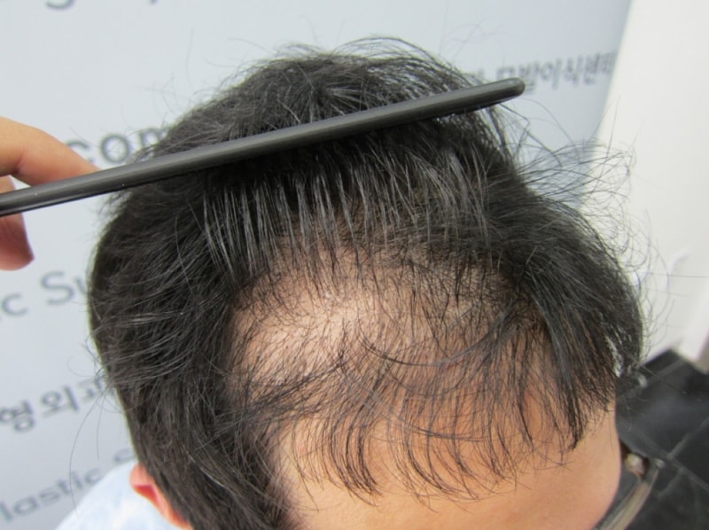 수술전3.JPG