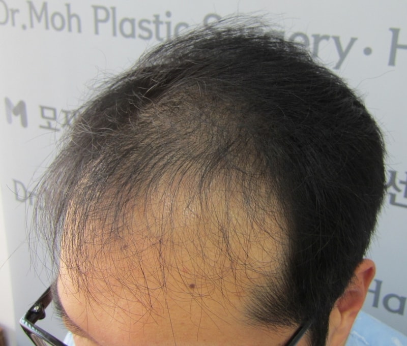 수술전3.JPG