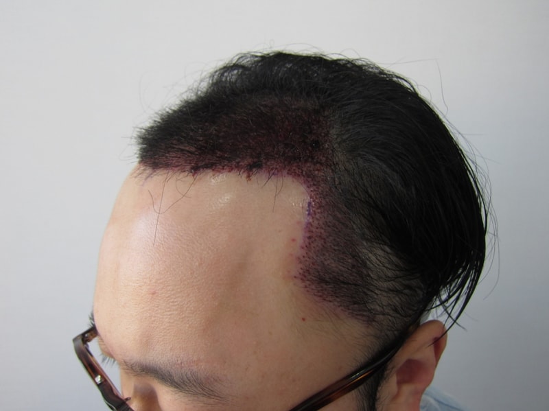 수술후3.JPG