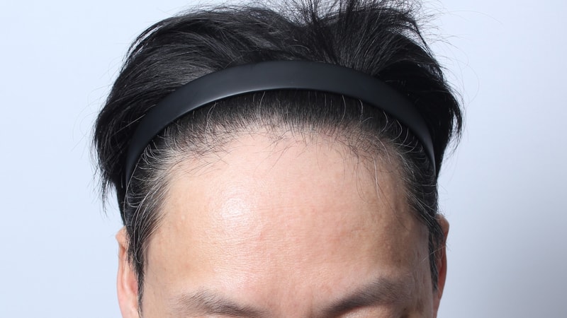 몇일 전 4개월 경과확인차 다녀왔습니다