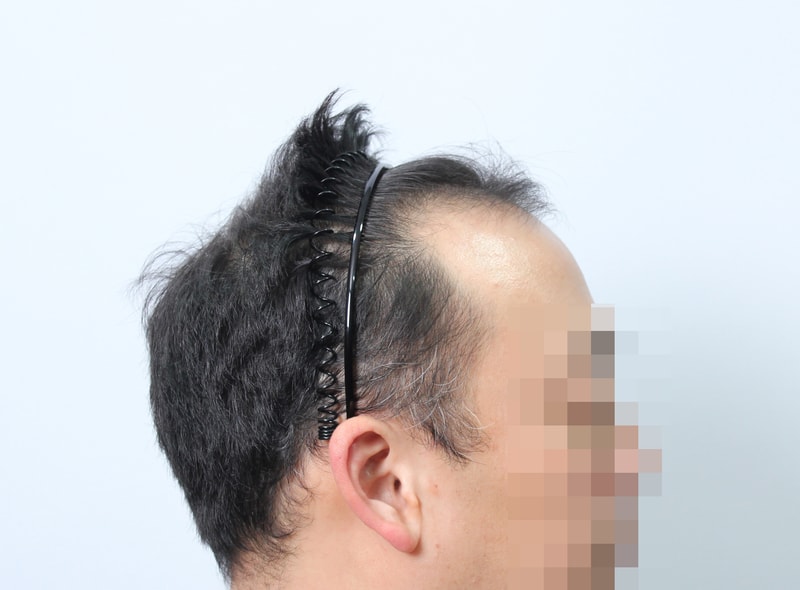 수술전  3.jpg