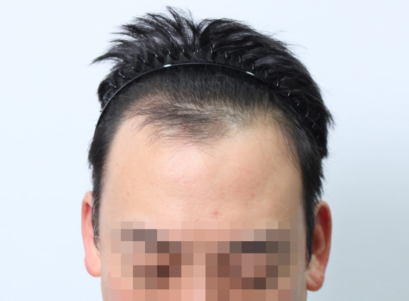 수술전  15.jpg