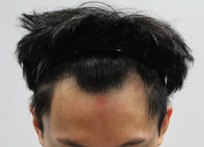 수술전.jpg